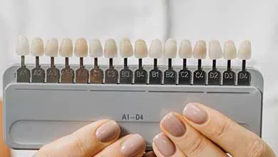 Hands holding a dental shade guide with artificial teeth in varying shades of white, labeled A1 to D4.
